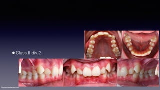 ©sylvainchamberland.com
•Class II div 2
MaHe220611
 