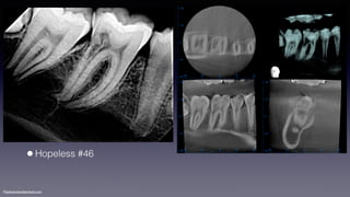 ©sylvainchamberland.com
•Hopeless #46
 