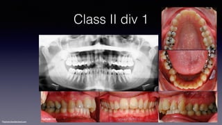 ©sylvainchamberland.com
Class II div 1
NaPa081105
 