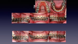 NP_3
NaPa010206
NaPa140306
 