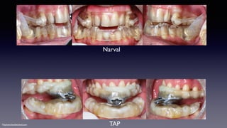 ©sylvainchamberland.com
Narval
TAP
 