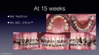 ©sylvainchamberland.com
At 15 weeks
•Md: 16x22 cnt
•Mx: ∆EC. .016 sc™
ClPe240912
 