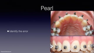 ©sylvainchamberland.com
Pearl
•Identify the error
 