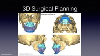 ©sylvainchamberland.com
3D Surgical Planning
 