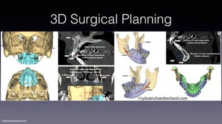 ©sylvainchamberland.com
3D Surgical Planning
 