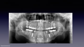 ©sylvainchamberland.com
 