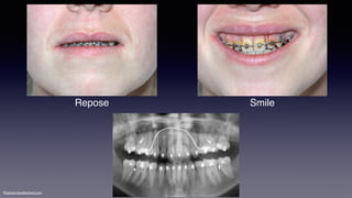 ©sylvainchamberland.com
Repose Smile
 