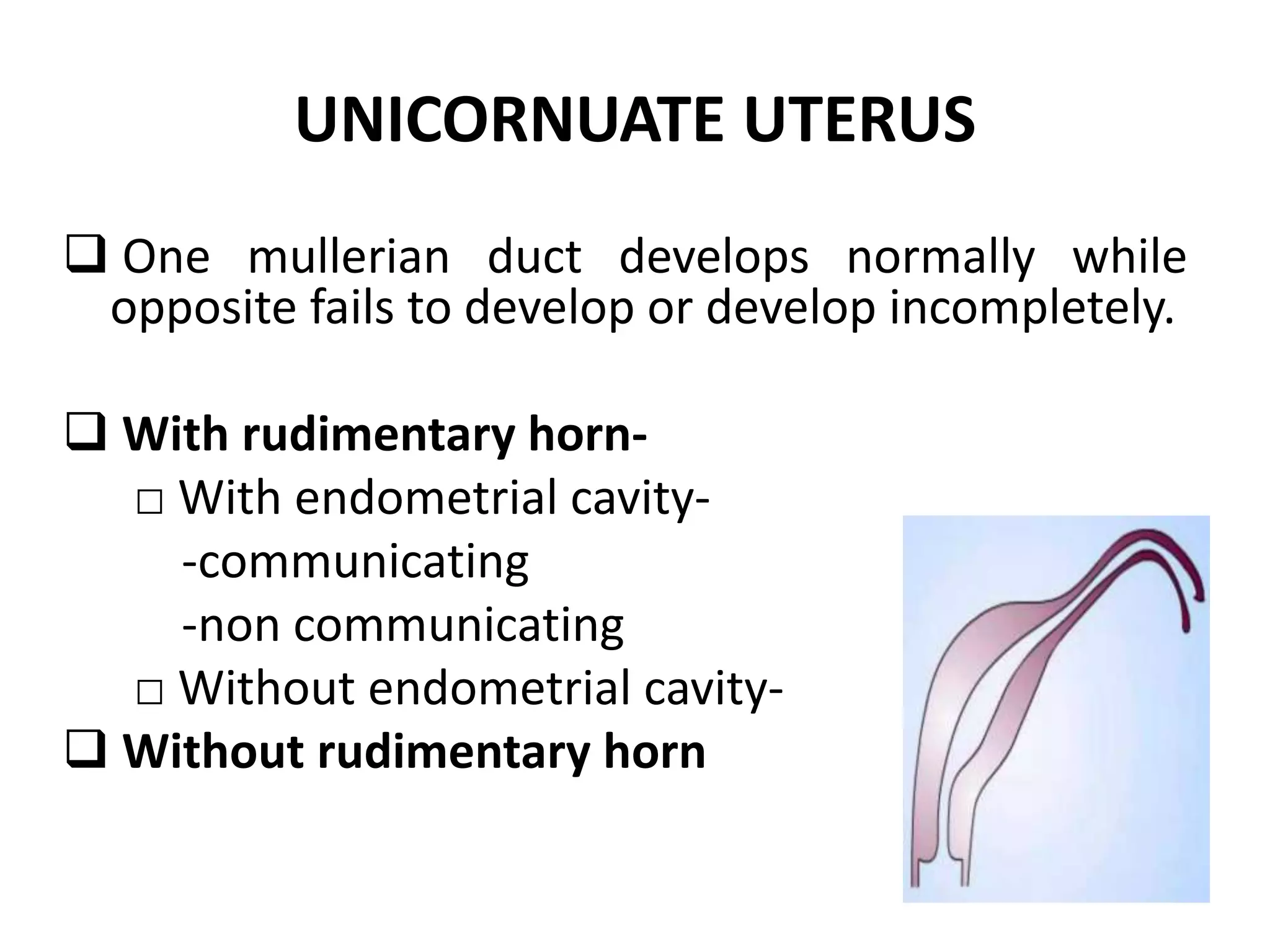 UNICORNUATE UTERUS 
 One mullerian duct develops normally while 
opposite fails to develop or develop incompletely. 
 With rudimentary horn- 
□ With endometrial cavity- 
-communicating 
-non communicating 
□ Without endometrial cavity- 
 Without rudimentary horn 
 