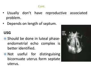  Fertility is not compromised yet has poorest reproductive 
outcome. 
 once pregnant, the greater the septum , greater t...
