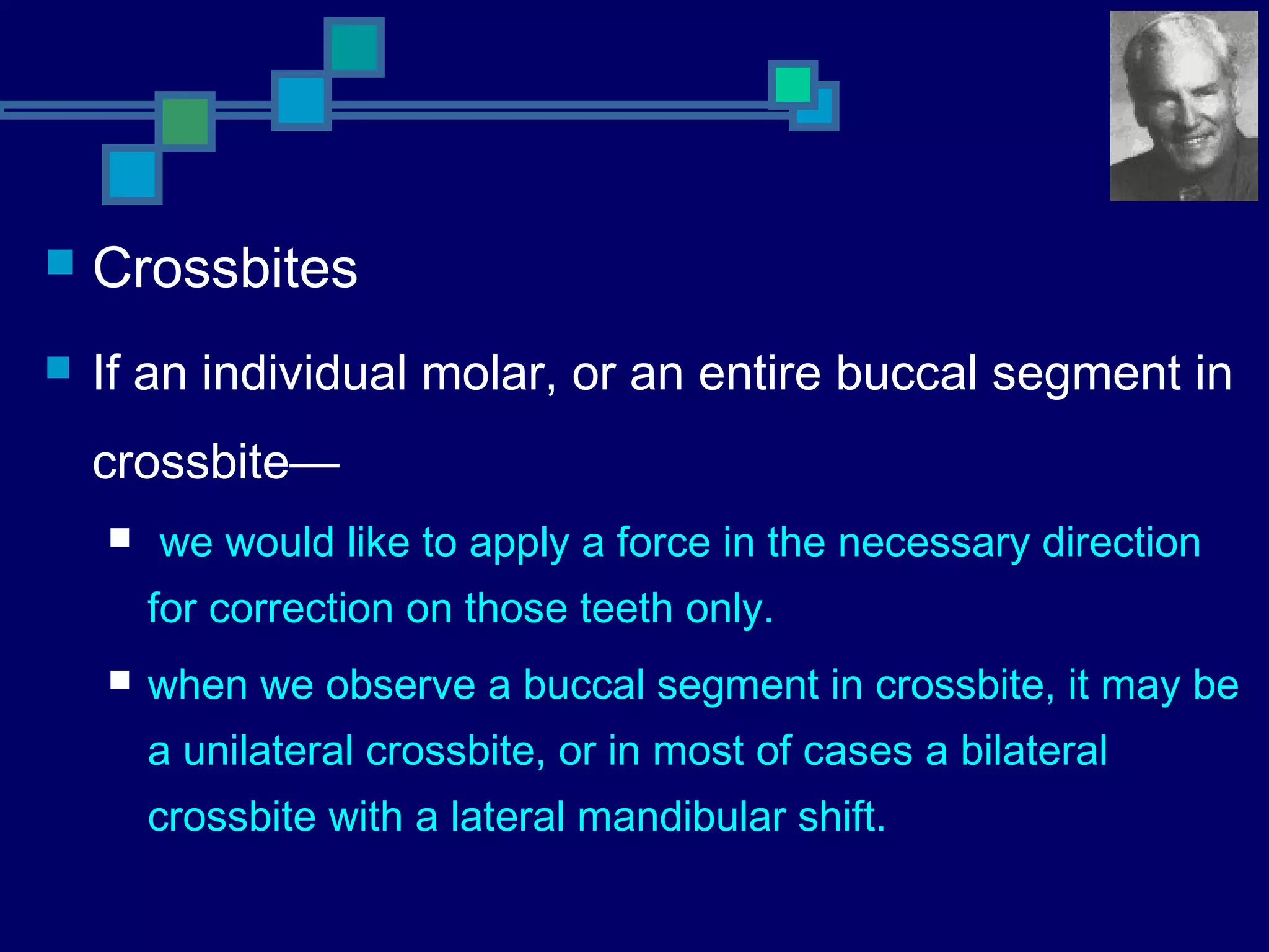  Crossbites
 If an individual molar, or an entire buccal segment in
crossbite—
 we would like to apply a force in the necessary direction
for correction on those teeth only.
 when we observe a buccal segment in crossbite, it may be
a unilateral crossbite, or in most of cases a bilateral
crossbite with a lateral mandibular shift.
 