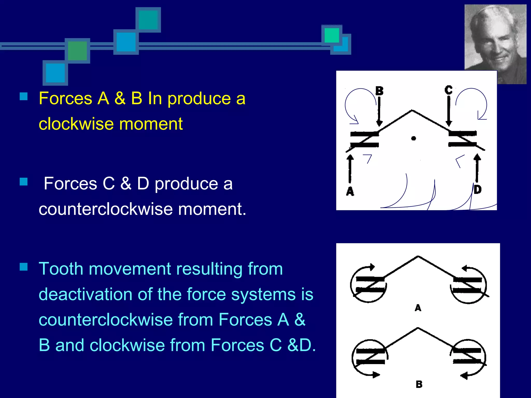  Forces A & B In produce a
clockwise moment
 Forces C & D produce a
counterclockwise moment.
 Tooth movement resulting from
deactivation of the force systems is
counterclockwise from Forces A &
B and clockwise from Forces C &D.
 