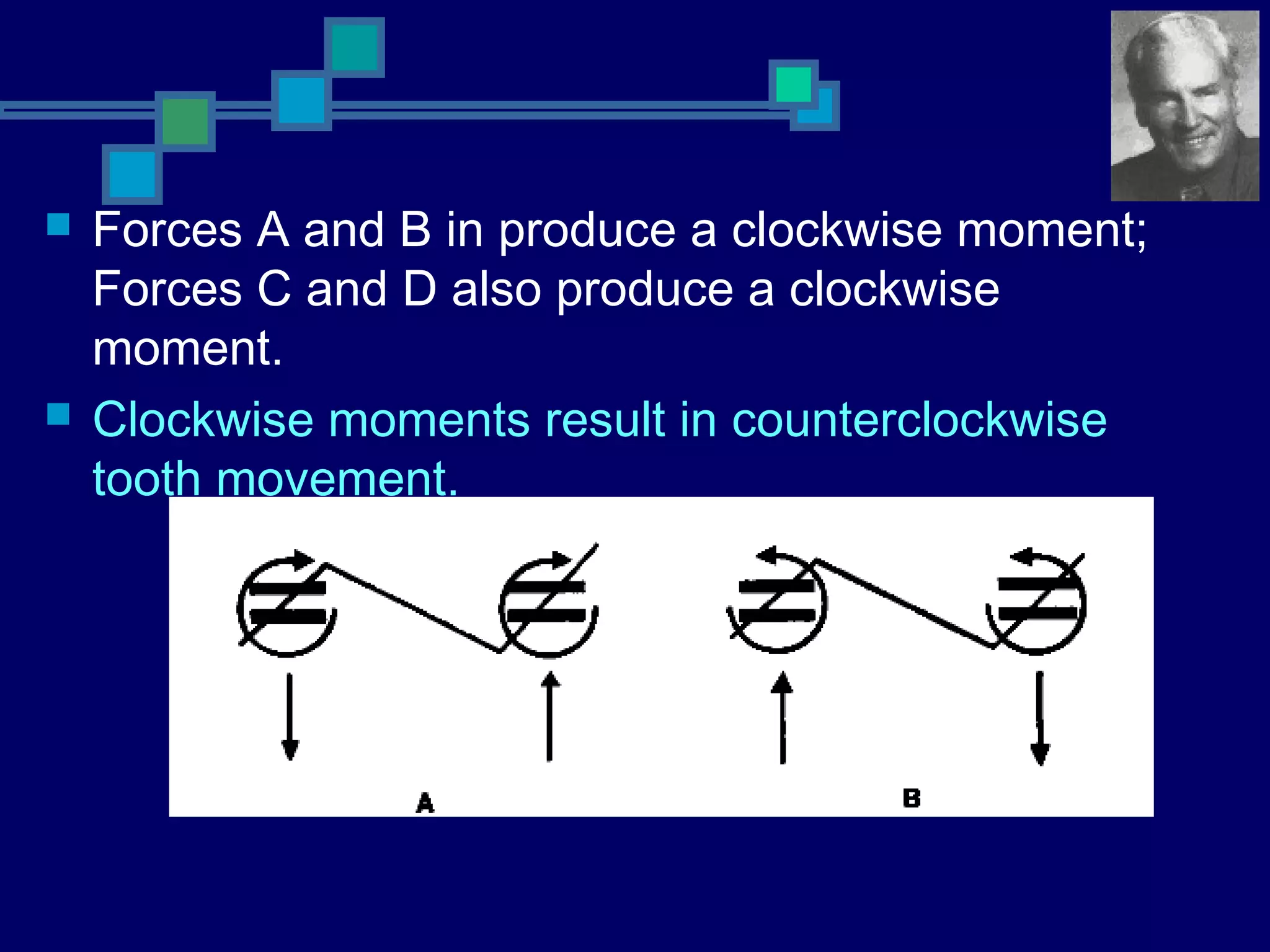  Forces A and B in produce a clockwise moment;
Forces C and D also produce a clockwise
moment.
 Clockwise moments result in counterclockwise
tooth movement.
 