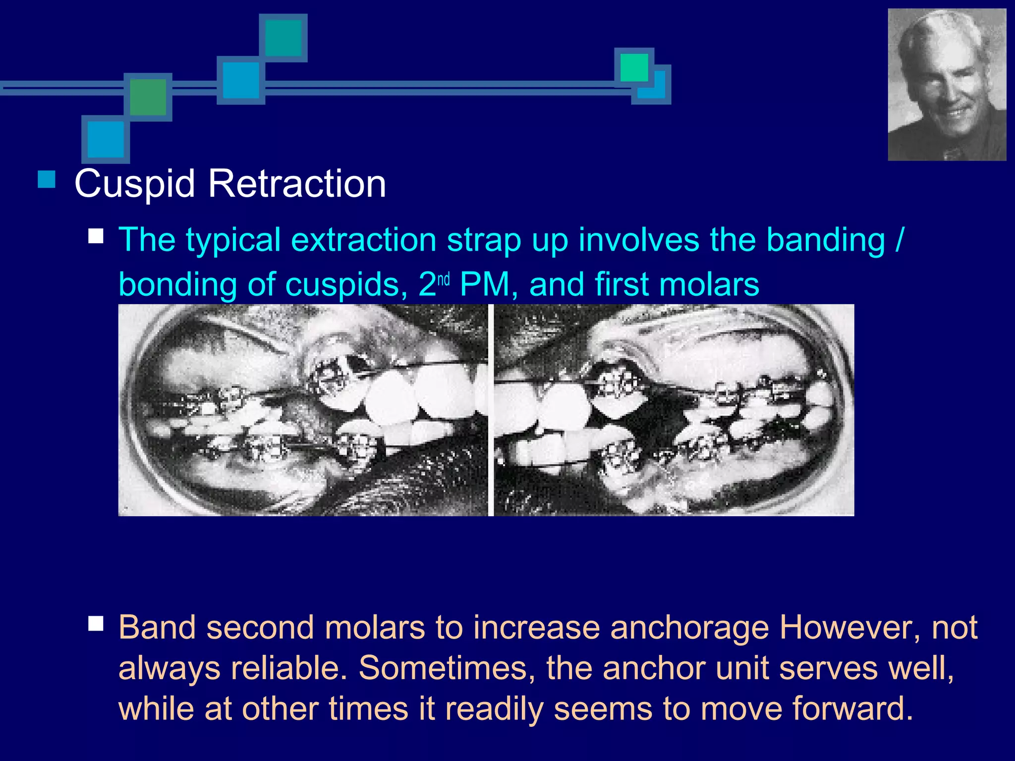  Cuspid Retraction
 The typical extraction strap up involves the banding /
bonding of cuspids, 2nd
PM, and first molars
 Band second molars to increase anchorage However, not
always reliable. Sometimes, the anchor unit serves well,
while at other times it readily seems to move forward.
 