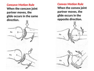 Convex Motion Rule
When the convex joint
partner moves, the
glide occurs in the
opposite direction.
Concave Motion Rule
When the concave joint
partner moves, the
glide occurs in the same
direction.
 