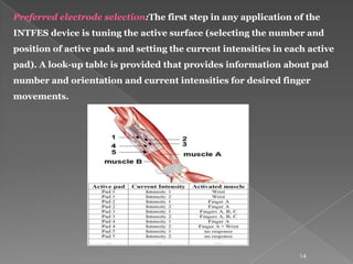 Multi pad electrode for effective grasping (2) | PPTX