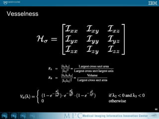 Anisotropic diffusion – OpenMP59void doAD ( Image* in, Image* out ) {  for ( int t = 0; t < TotalTime; t++ ) {#pragmaomp parallel for    for ( int z = 1; z < in->mDepth-1; z++ ) {      short* previousSlice = in->mSlicePointers[z-1];      short* slice = in->mSlicePointers[z];      short* nextSlice = in->mSlicePointers[z+1];      for ( int y = 1; y < in->mHeight-1; y++ ) {        short* previousRow = slice + y-1 * in->mWidth;        short* row = slice + y * in->mWidth;        short* nextRow = slice + y-1 * in->mWidth;        short* aboveRow = previousSlice + y * in->mWidth;        short* belowRow = nextSlice + y * in->mWidth;        for ( int x = 1; i < in->mWidth-1; x++ ) {dx = 2 * row[x] – row[x-1] – row[x+1];dy = 2 * row[x] – previousRow[x] – nextRow[x];dz = 2 * row[x] – aboveRow[x] – belowRow[x];          ...
