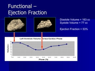 Functional –  Ejection Fraction Diastole Volume = 163 cc Systole Volume = 77 cc Ejection Fraction   = 53% 