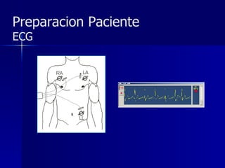 Preparacion Paciente  ECG 
