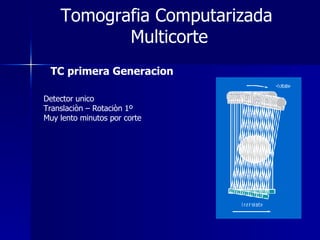 Tomografia Computarizada  Multicorte TC primera Generacion Detector unico Translaciòn – Rotaciòn 1º Muy lento minutos por corte 