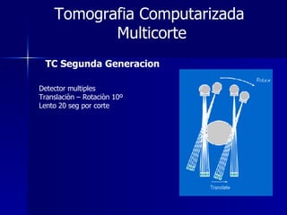 Tomografia Computarizada  Multicorte TC Segunda Generacion Detector multiples Translaciòn – Rotaciòn 10º Lento 20 seg por corte 