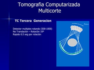 Tomografia Computarizada  Multicorte TC Tercera  Generacion Detector multiples rotando (500-1000) No Translaciòn – Rotaciòn 10º Rapido 0.5 seg por rotaciòn 