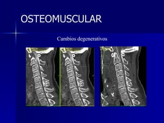 Cambios degenerativos OSTEOMUSCULAR 
