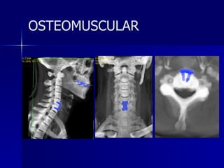 OSTEOMUSCULAR 