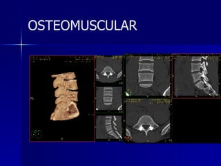 OSTEOMUSCULAR 