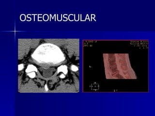 OSTEOMUSCULAR 