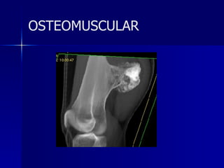 OSTEOMUSCULAR 