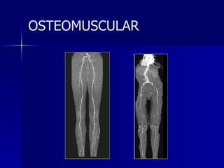 OSTEOMUSCULAR 