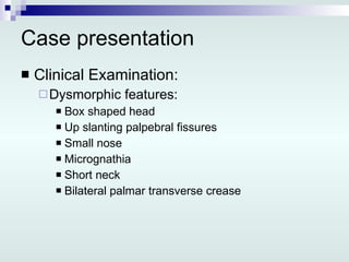 Case presentation Clinical Examination: Dysmorphic features: Box shaped head Up slanting palpebral fissures Small nose Micrognathia Short neck Bilateral palmar transverse crease 