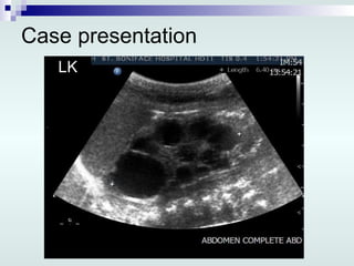 Case presentation LK 