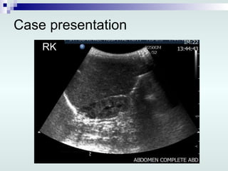Case presentation RK 