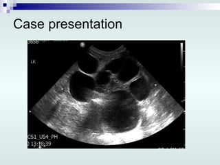Case presentation 