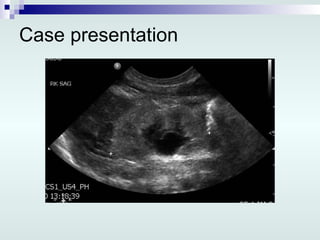 Case presentation 