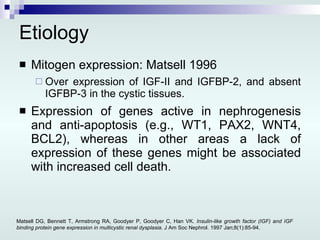 Etiology Mitogen expression: Matsell 1996 Over expression of IGF-II and IGFBP-2, and absent IGFBP-3 in the cystic tissues. Expression of genes active in nephrogenesis and anti-apoptosis (e.g., WT1, PAX2, WNT4, BCL2), whereas in other areas a lack of expression of these genes might be associated with increased cell death. Matsell DG, Bennett T, Armstrong RA, Goodyer P, Goodyer C, Han VK.  Insulin-like growth factor (IGF) and IGF binding protein gene expression in multicystic renal dysplasia.  J Am Soc Nephrol. 1997 Jan;8(1):85-94. 