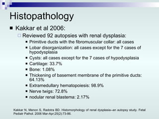 Histopathology Kakkar et al 2006: Reviewed 92 autopsies with renal dysplasia: Primitive ducts with the fibromuscular collar: all cases Lobar disorganization: all cases except for the 7 cases of hypodysplasia Cysts: all cases except for the 7 cases of hypodysplasia Cartilage: 33.7% Bone: 1.08% Thickening of basement membrane of the primitive ducts: 64.13% Extramedullary hematopoiesis: 98.9% Nerve twigs: 72.8% nodular renal blastema: 2.17% Kakkar N, Menon S, Radotra BD.  Histomorphology of renal dysplasia--an autopsy study.  Fetal Pediatr Pathol. 2006 Mar-Apr;25(2):73-86. 
