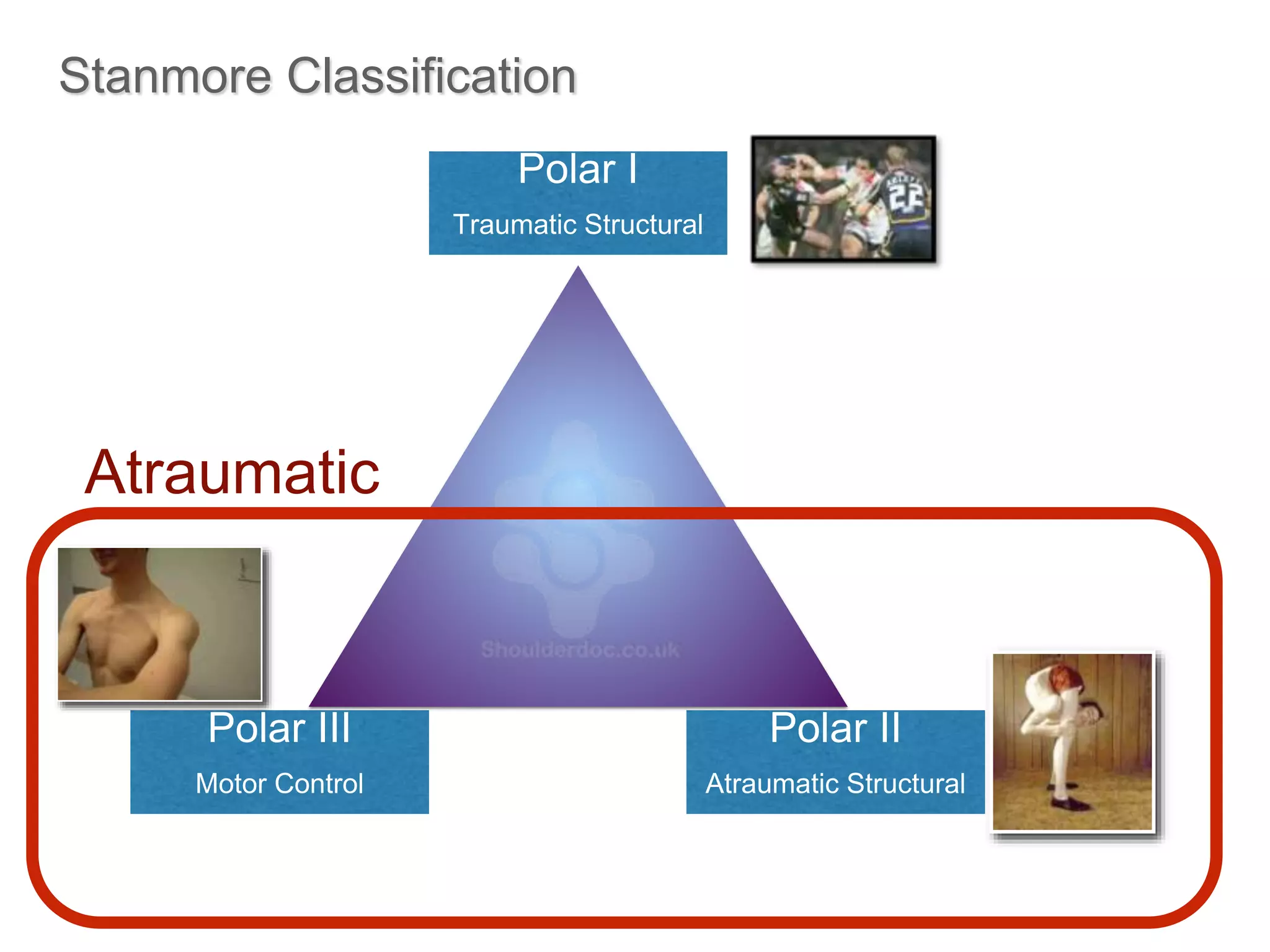 Stanmore Classification 
Atraumatic 
wwwwww.w.wrigrhigtinhgttionng.ctoomn.com 
13 
Small lesion Repair 
Capsular Plications 
Polar I 
Traumatic Structural 
Polar II 
Atraumatic Structural 
Polar III 
Motor Control 
Large lesion Repair 
Bony Reconstructions 
Rehab +/- 
Capsular Plication 
Specialist 
Rehab. 
 