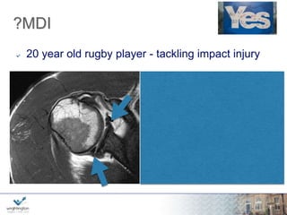 wwwwww.w.wrigrhigtinhgttionng.ctoomn.com 
nferior 
shift 
eh 
abilitation 
ilateral 
ultidirection 
al 
traumatic 
Range AMBRI 
TUBS 
7 
urgery 
ankart 
nidirectional 
umatic 
ra 
 