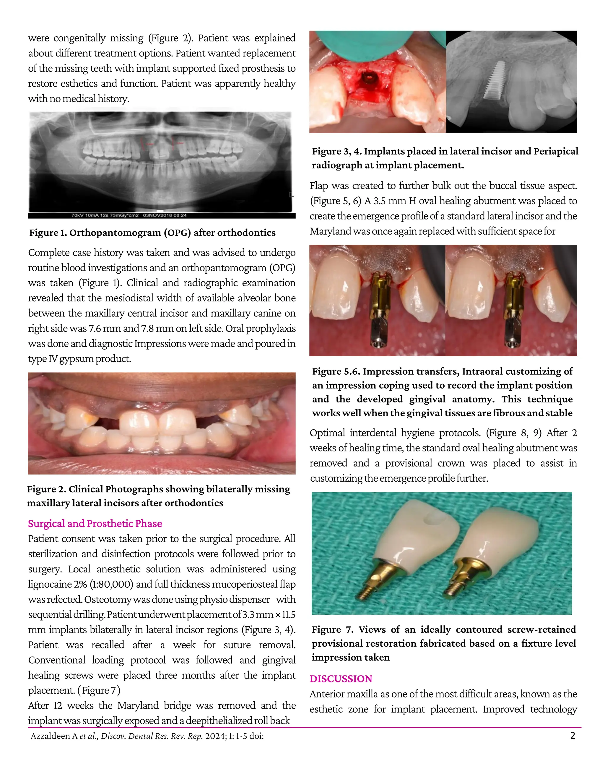 Multidisciplinary Approach for Management of Congenitally Missing.pdf