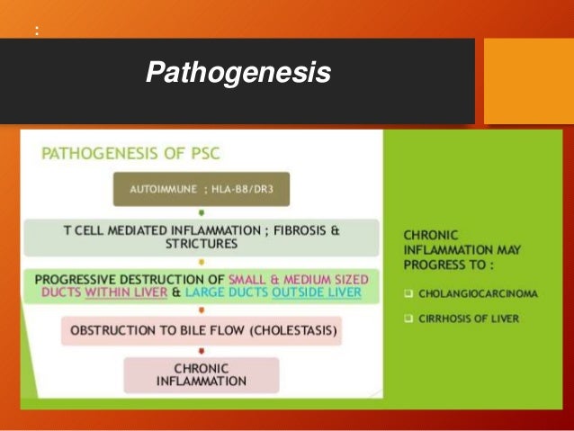Image result for primary sclerosing cholangitis