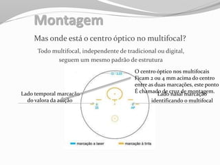 Montagem
Mas onde está o centro óptico no multifocal?
Todo multifocal, independente de tradicional ou digital,
seguem um mesmo padrão de estrutura
Lado temporal marcação
do valora da adição
Lado nasal marcação
identificando o multifocal
O centro óptico nos multifocais
Ficam 2 ou 4 mm acima do centro
entre as duas marcações, este ponto
É chamado de cruz de montagem.
 