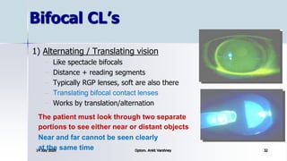 Multifocal Rgp Multifocal cl by ankit varshney | PPTX