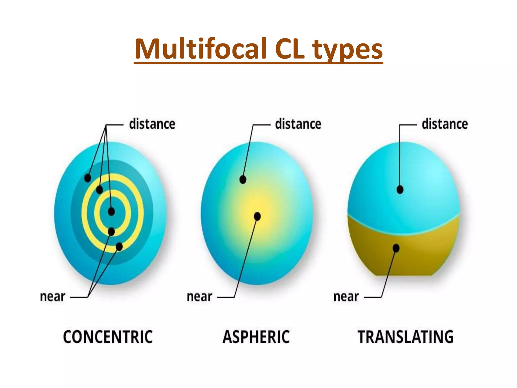 Multifocal Contact Lenses PPTX