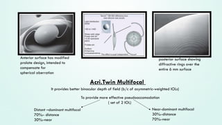 Let's learn everything about MULTIFOCAL IOL .pptx