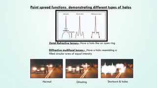 Multifocal Power Rings Let's learn everything about MULTIFOCAL IOL .pptx