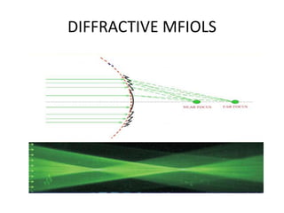 Multifocal iols | PPTX