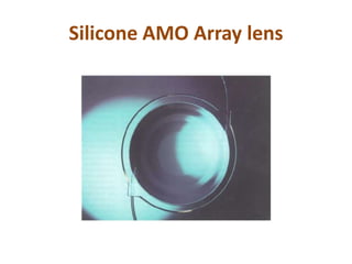 Multifocal iols | PPTX