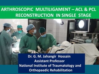 Multiligament Injury of Knee and ACL & PCL Reconstruction | PPTX